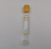 Vacuum Blood Collection Tubes 100pcs Yellow Top Blood Collection Tubes