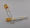 Yellow Top Disposable Vacuum Gel And Clot Activator Blood Collection Tube SST
